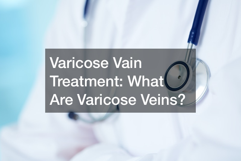 Varicose Vain Treatment  What Are Varicose Veins?